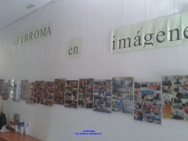 Exposición AFIBROMA