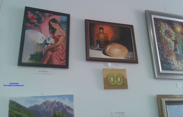 Exposición AFIBROMA
