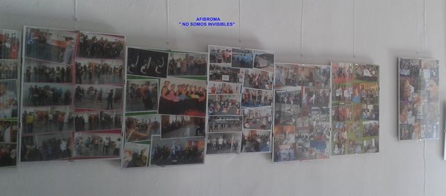 Exposición AFIBROMA